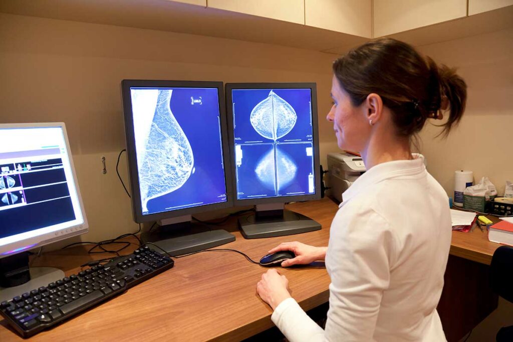 radiologist examining mammogram